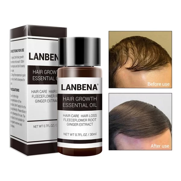 روغن تقویت کننده مو Lanbena مدل ESSENCE GROWTH